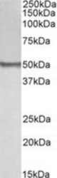 BLK antibody (0.1 ug/ml) staining of Human Thymus lysate (35 ug protein/ml in RIPA buffer). Primary incubation was 1 hour. Detected by chemiluminescence.