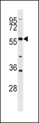 BLK Antibody (G1) western blot of HL-60 cell line lysates (35 ug/lane). The BLK antibody detected the BLK protein (arrow).