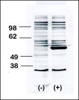Western blot of anti-BLK antibody transiently transfected HEK-293 cell line lysate (1 ug/lane). BLK antibody(arrow) was detected using the purified antibody.