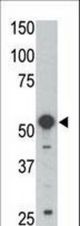 Western blot of anti-BLK antibody in mouse kidney tissue lysate. BLK (arrow) was detected using purified antibody. Secondary HRP-anti-rabbit was used for signal visualization with chemiluminescence.