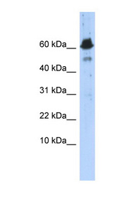 ABAT antibody LS-C111326 Western blot of Transfected 293T cell lysate.