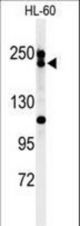 Western blot of BLM Antibody in HL-60 cell line lysates (35 ug/lane). BLM (arrow) was detected using the purified antibody.