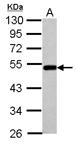 Sample (30 ug of whole cell lysate) A: A549 10% SDS PAGE BLMH antibody diluted at 1:1000