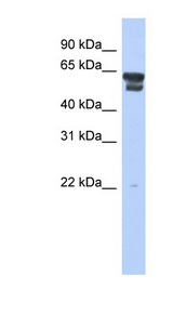 BLMH antibody LS-C111801 Western blot of 721_B cell lysate.