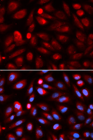 Immunofluorescence analysis of U2OS cell using ACP5 antibody. Blue: DAPI for nuclear staining.