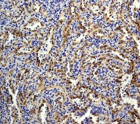 IHC of paraffin-embedded human spleen tissue using anti-BLNK antibody.