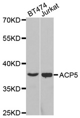 Western blot analysis of extracts of various cell lines, using ACP5 antibody.