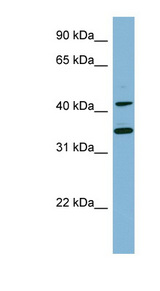 BLNK antibody LS-C107723 Western blot of NCI-H226 cell lysate.