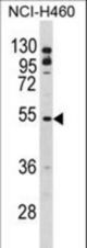 Western blot of BLNK Antibody in NCI-H460 cell line lysates (35 ug/lane). BLNK (arrow) was detected using the purified antibody.
