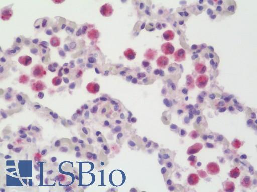 Anti-ACP5 / TRAP antibody IHC staining of human lung. Immunohistochemistry of formalin-fixed, paraffin-embedded tissue after heat-induced antigen retrieval. Antibody LS-B10902 concentration 5 ug/ml.
