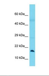 Western blot of Human Lung Tumor. BLOC1S1 antibody dilution 1.0 ug/ml.