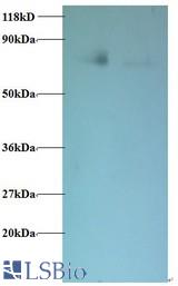 Western blot of Biogenesis of lysosome-related organelles complex 1 subunit 1 antibody at 2 ug/ml. Lane 1: EC109 whole cell lysate. Lane 2: 293T whole cell lysate. Secondary: Goat polyclonal to Rabbit IgG at 1:15000 dilution. Predicted band size: 16 kDa. Observed band size: 75 kDa.