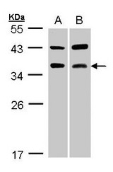 Sample (30 ug whole cell lysate). A: A431, B: MOLT4 . 12% SDS PAGE. ACP5 / TRAP antibody diluted at 1:1000