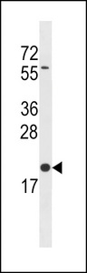 BLOC1S3 Antibody western blot of A2058 cell line lysates (35 ug/lane). The BLOC1S3 antibody detected the BLOC1S3 protein (arrow).