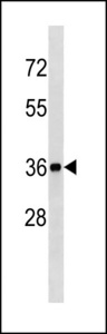 BLVRA Antibody (Center Y83) western blot of mouse kidney tissue lysates (35 ug/lane). The BLVRA antibody detected the BLVRA protein (arrow).