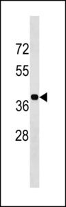 BLVRA Antibody (Center Y83) western blot of K562 cell line lysates (35 ug/lane). The BLVRA antibody detected the BLVRA protein (arrow).
