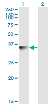 Western blot of BLVRA expression in transfected 293T cell line by BLVRA monoclonal antibody (M03), clone S2.