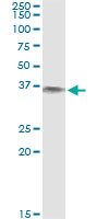 Immunoprecipitation of BLVRA transfected lysate using anti-BLVRA monoclonal antibody and Protein A Magnetic Bead.
