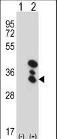Western blot of BLVRA (arrow) using rabbit polyclonal BLVRA Antibody. 293 cell lysates (2 ug/lane) either nontransfected (Lane 1) or transiently transfected (Lane 2) with the BLVRA gene.