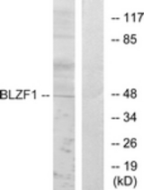Western blot of extracts from Jurkat cells, using BLZF1 Antibody. The lane on the right is treated with the synthesized peptide.