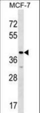 MRPL1 Antibody western blot of MCF-7 cell line lysates (35 ug/lane). The MRPL1 antibody detected the MRPL1 protein (arrow).