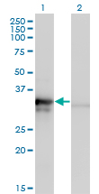 Western blot of MRPL1 expression in transfected 293T cell line by MRPL1 monoclonal antibody (M02), clone 2C4.