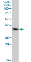 MRPL1 monoclonal antibody (M02), clone 2C4. Western blot of MRPL1 expression in A-431.