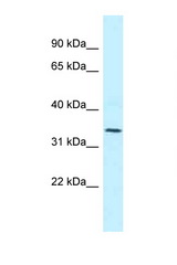 MRPL1 antibody LS-C145906 Western blot of Jurkat Cell lysate. Antibody concentration 1 ug/ml.