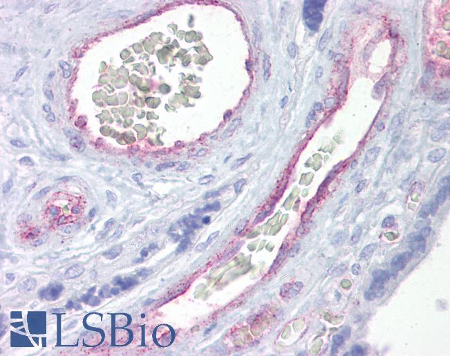 Anti-ARNTL2 antibody IHC of human placenta. Immunohistochemistry of formalin-fixed, paraffin-embedded tissue after heat-induced antigen retrieval. Antibody LS-B6621 concentration 5 ug/ml.