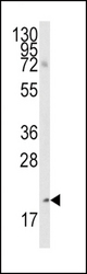 Western blot of anti-Bmf BH3 Domain Antibody in A2058 cell line lysates (35 ug/lane). Bmf(arrow) was detected using the purified antibody.