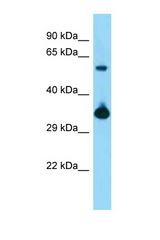 BMI1 antibody LS-C146455 Western blot of Mouse Kidney lysate. Antibody concentration 1 ug/ml.