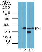 Western blot of BMI1 in skeletal muscle lysate. Lane 1 shows pre-immune sera. Lanes 2, 3 and 4 show LS-C148527 tested on human, mouse and rat muscle lysate at 2 ug/ml, respectively. Goat anti-rabbit Ig HRP secondary antibody, and PicoTect ECL substrate solution, were used for this test.