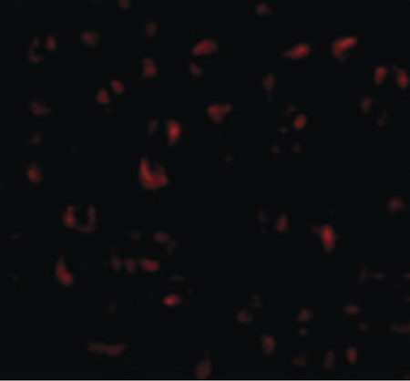 Immunofluorescence of BMI-1 in K562 cells with BMI-1 antibody at 20 ug/ml.