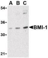 Western blot of BMI-1 in K562 cell lysate with LS-C19577 at (A) 0.5, (B) 1 and (C) 2 ug/ml.
