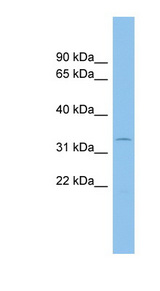 ACP5 antibody LS-C116194 Western blot of THP-1 cell lysate.