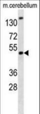 Mouse Bmi1 antibody western blot of mouse cerebellum tissue lysates (35 ug/lane). The Mouse Bmi1 antibody detected the Mouse Bmi1 protein (arrow).