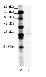 A: Marker, B: A172 Cell Lysate
