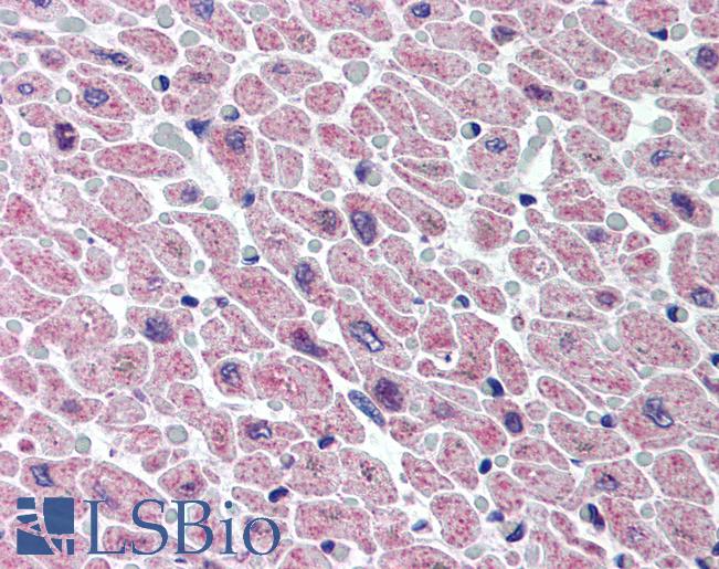 Anti-BMP10 antibody IHC of human heart. Immunohistochemistry of formalin-fixed, paraffin-embedded tissue after heat-induced antigen retrieval. Antibody LS-B202 concentration 20 ug/ml.