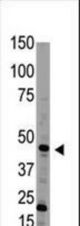 Western blot of anti-Bmp15 Antibody in HL60 cell line lysate (35 ug/lane). Bmp15(arrow) was detected using the purified antibody.