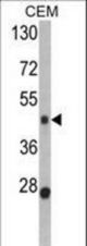 Western blot of BMP15 Antibody in CEM cell line lysates (35 ug/lane). BMP15 (arrow) was detected using the purified antibody.