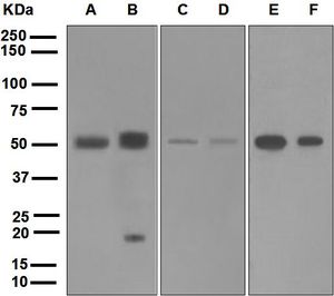 Western blot analysis on (A) ovary cancer, (B) uterus, (C) HL-60, (D) NIH: OVCAR-3, (E) human testis, and (F) HeLa cell lysates using anti-BMP15 antibody.