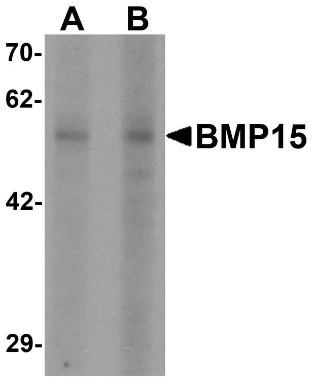Western blot analysis of BMP15 in 3T3 cell lysate with BMP15 antibody at (A) 1 and (B) 2 ug/ml