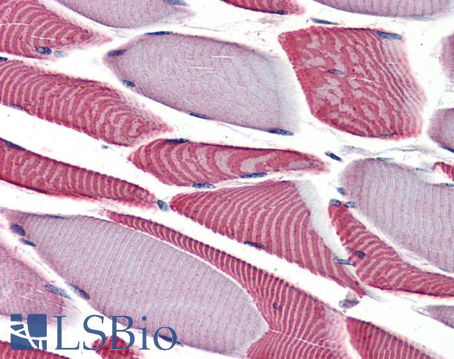 Anti-BMP2K antibody LS-A6938 IHC of human skeletal muscle. Immunohistochemistry of formalin-fixed, paraffin-embedded tissue after heat-induced antigen retrieval.