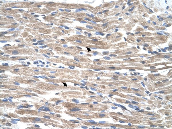 BMP2K antibody LS-C80510 was used in IHC to stain formalin-fixed, paraffin-embedded human muscle.