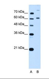 Lane A: Marker. Lane B: HepG2 cell lysate. Antibody concentration: 5.0 ug/ml. Gel concentration: 12%.