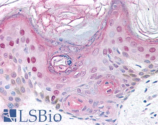 Anti-BMP2K antibody IHC of human skin. Immunohistochemistry of formalin-fixed, paraffin-embedded tissue after heat-induced antigen retrieval. Antibody LS-B783 concentration 10 ug/ml.