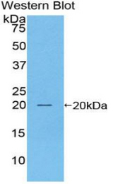 Western blot of recombinant ACPP / PAP.