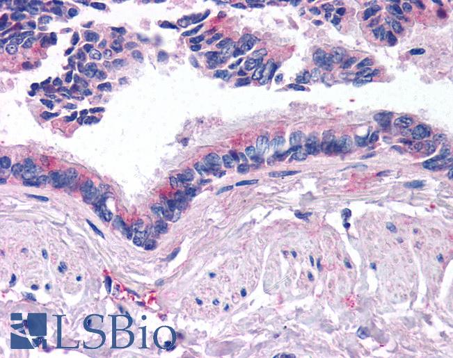 Anti-BMP5 antibody IHC of human lung, respiratory epithelium. Immunohistochemistry of formalin-fixed, paraffin-embedded tissue after heat-induced antigen retrieval. Antibody LS-B788 concentration 10 ug/ml.