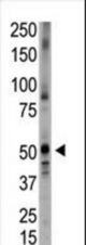 The anti-Bmp5 N-term antibody is used in Western blot to detect Bmp5 in placenta tissue lysate.