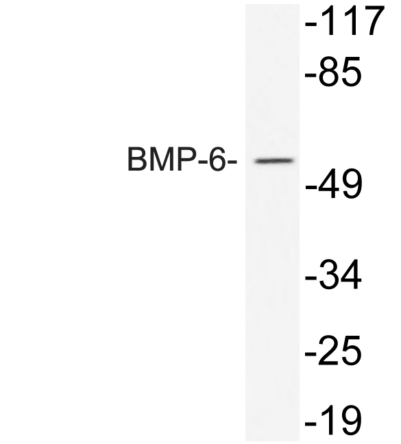Western blot of BMP-6 (A152) pAb in extracts from 293 cells treated with TNF.